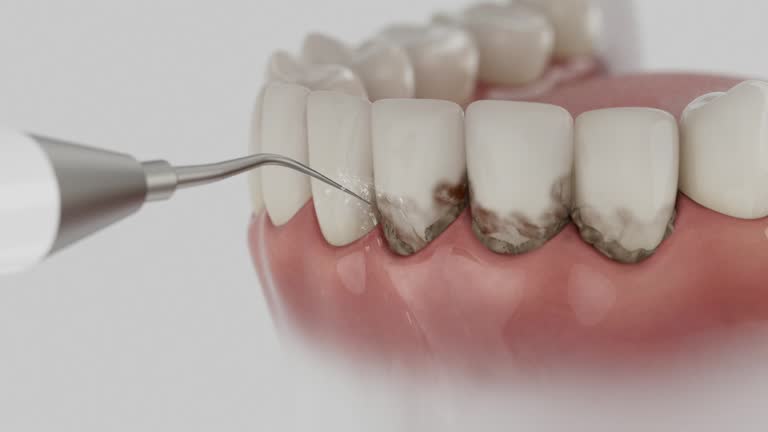 Reliable Tooth Extraction contractor in Bowling Green, MD by Smile Center Dentistry